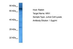 KRI1 Rabbit anti-Human, Polyclonal, Novus Biologicals 0.1 mL | Buy Online | Novus Biologicals | Fisher Scientific